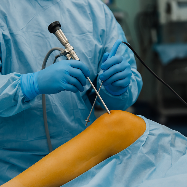 is-arthroscopy-considered-surgery