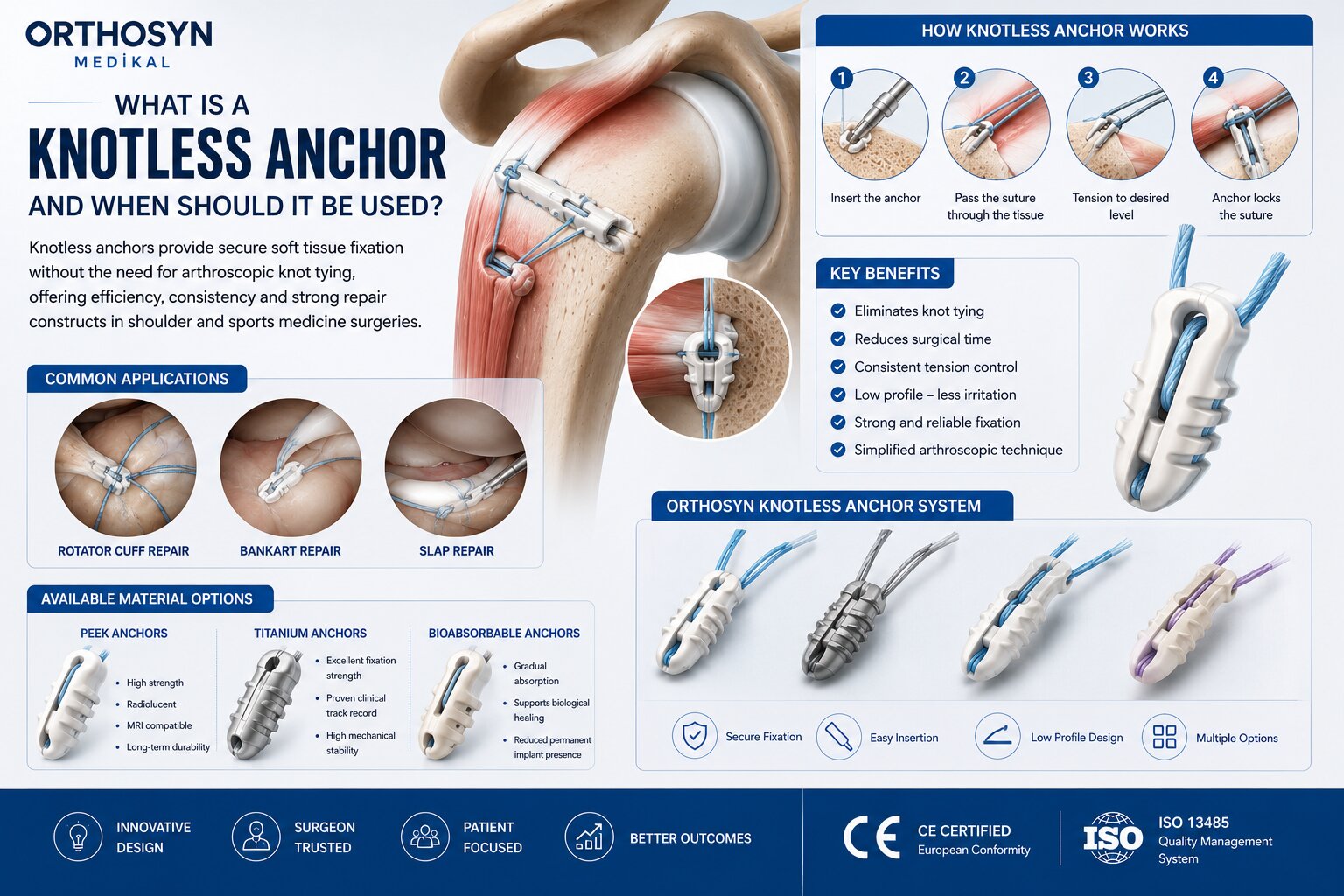 what-is-a-knotless-anchor-and-when-should-it-be-used