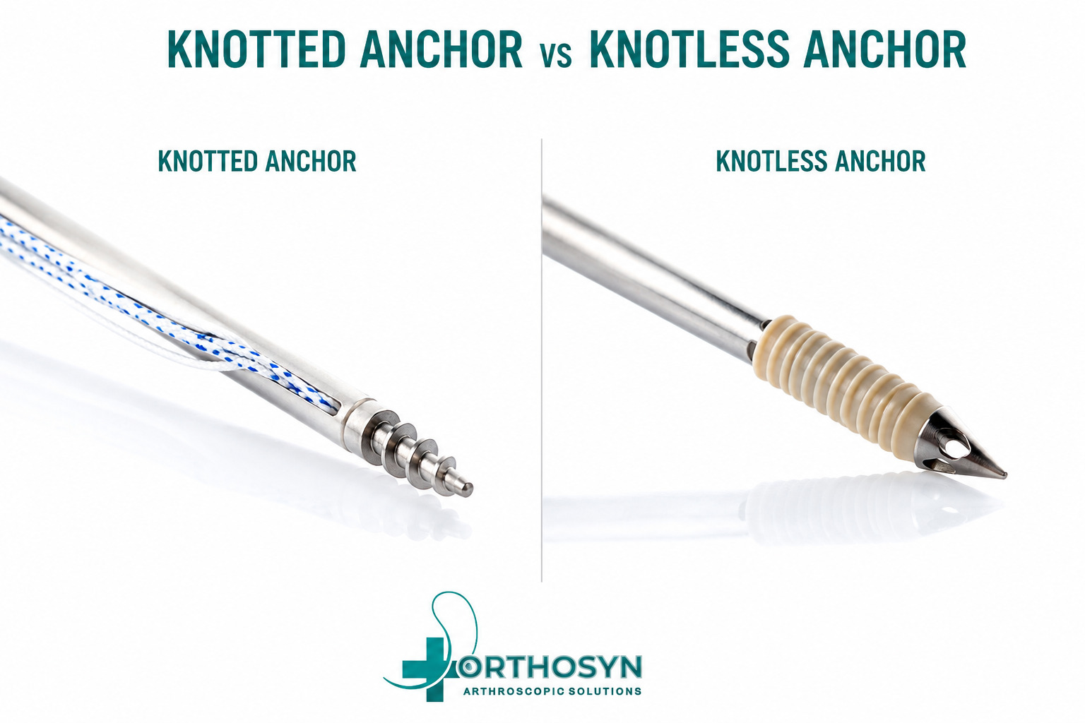 knotless-vs-knotted-suture-anchors-what-is-the-difference-orthosyn