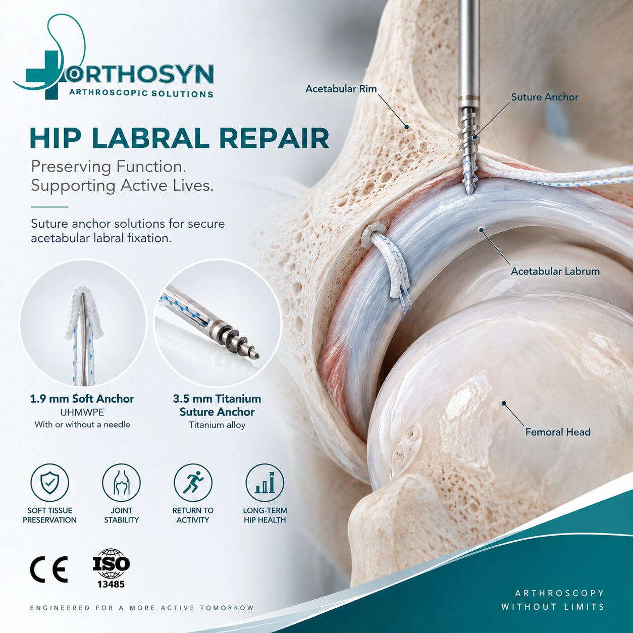 how-are-suture-anchors-used-in-hip-labral-repair