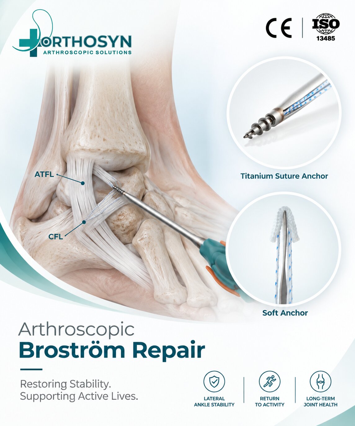 what-is-arthroscopic-brostrom-repair