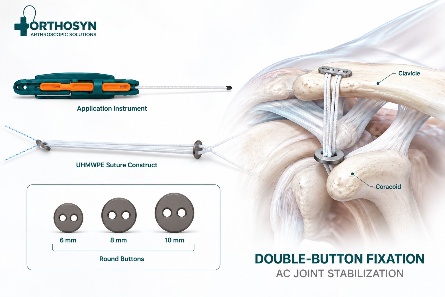 how-does-double-button-fixation-work-in-ac-joint-stabilization