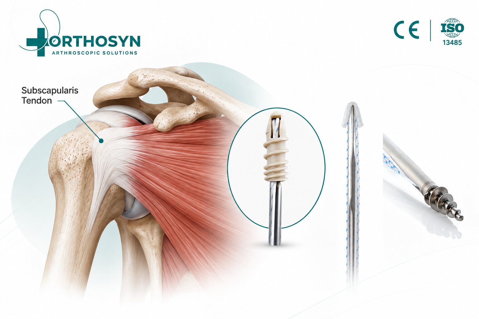 how-is-the-subscapularis-tendon-repaired-arthroscopically