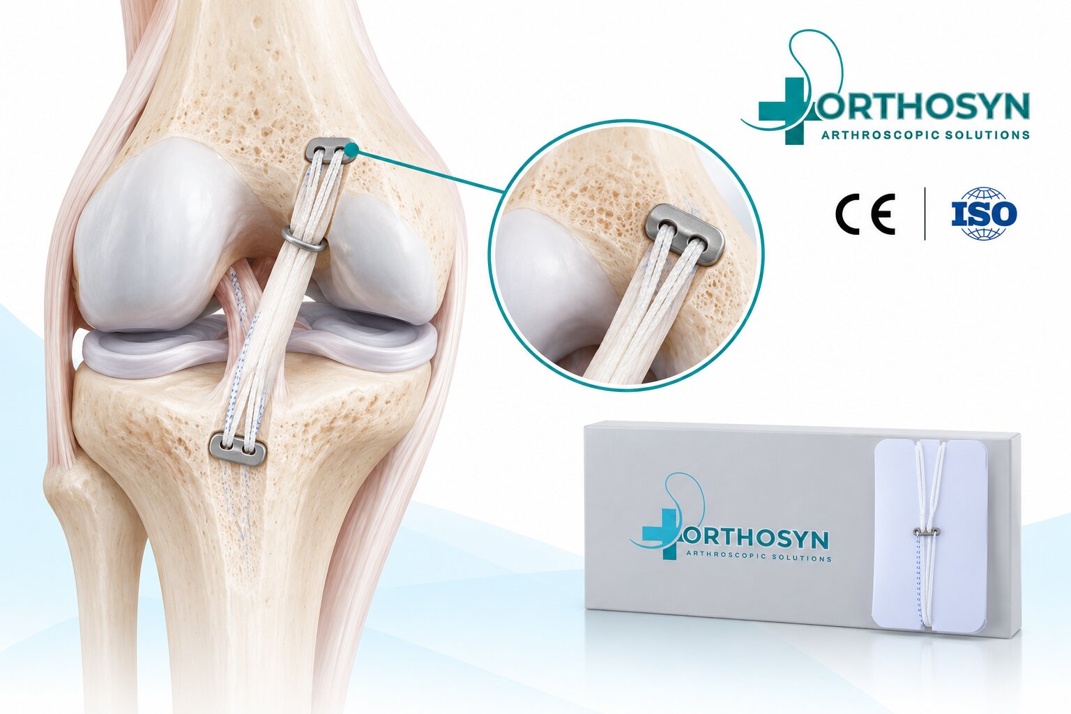what-is-all-inside-acl-reconstruction-and-how-is-the-graft-fixed